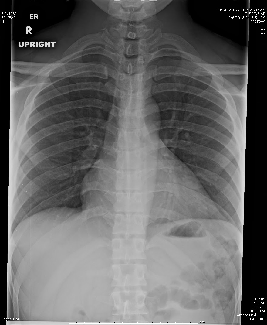 thoracic radiography